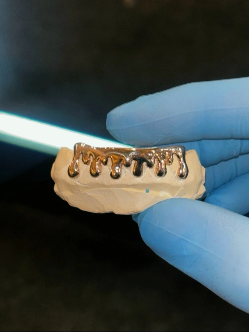 Custom Grillz Mold Kit – Start Your Custom Grillz Order – $150 Deposit